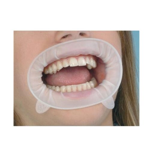 تصویر  دهان باز کن اپتراگیت ایوکلار / Ivoclar Vivadent optragate